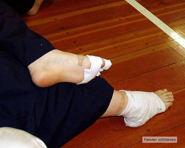 Die eine oder andere kleine Blessur